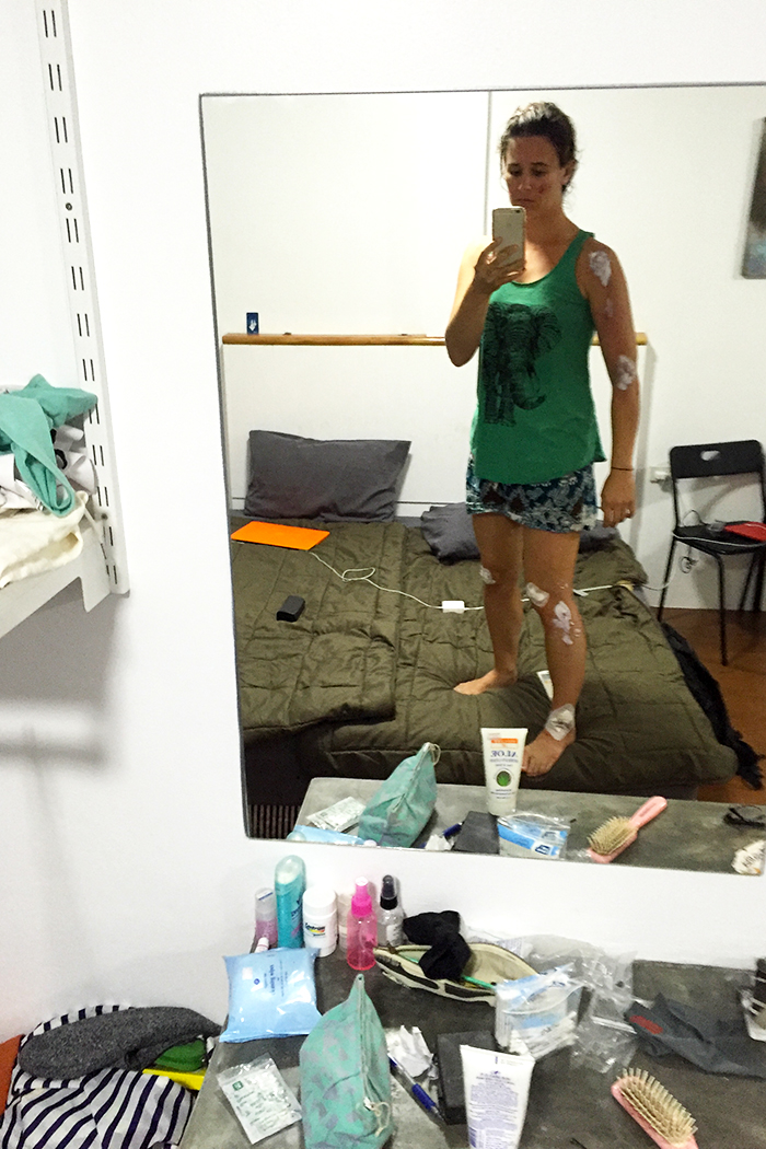 serious road rash is no fun